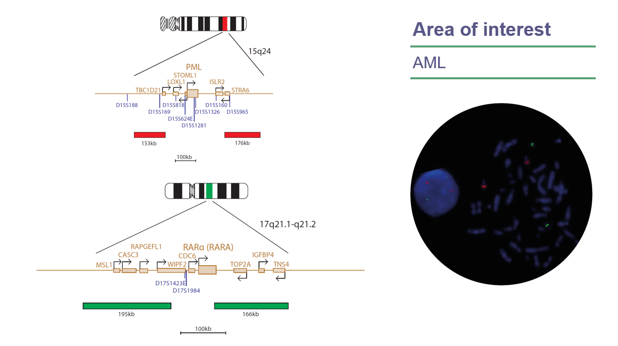 CytoCell FAST PML/RARα(RARA) Translocation FISH Probe | OGT