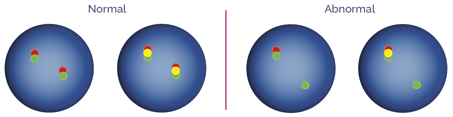 Common FISH Signal Patterns | OGT