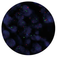 Fluorescence in situ hybridisation (FISH) microscope image of the CytoCell IGH/MYC Translocation, Dual Fusion probe.