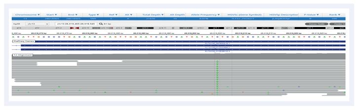 Figure 3. Example of a SNV detection FLT3 c.2503 GT (p.Asp835Tyr)